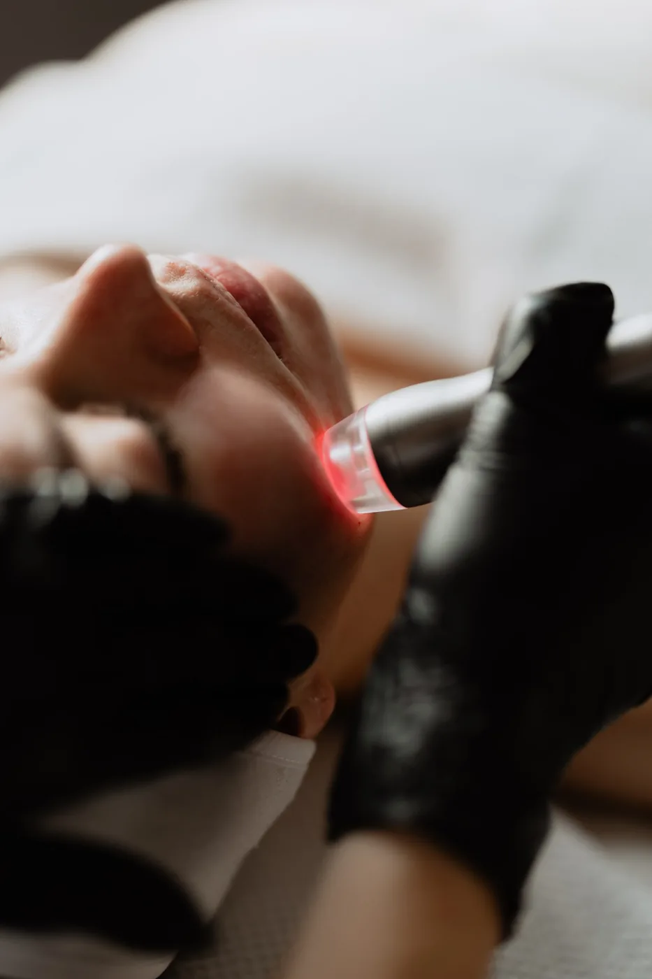 Skin Training med pulserende vakuum